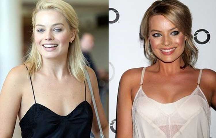 Margot Robbie Plastic Surgery