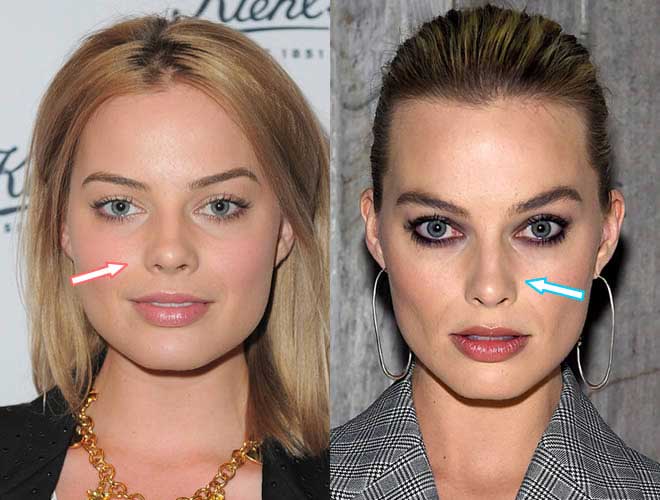 Margot Robbie Plastic Surgery: Exploring The Truth Behind Her Changing ...