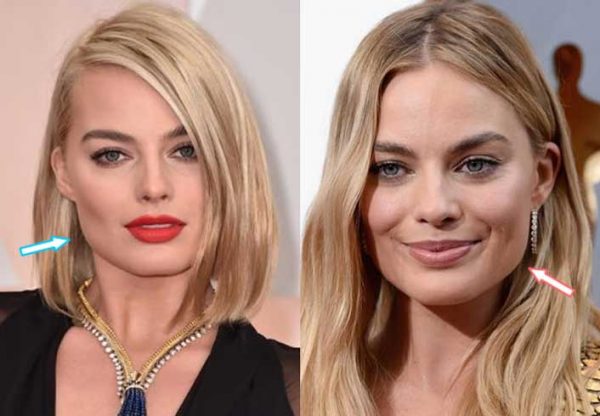 Margot Robbie Plastic Surgery: Nose Job, Botox injections, Boob Job