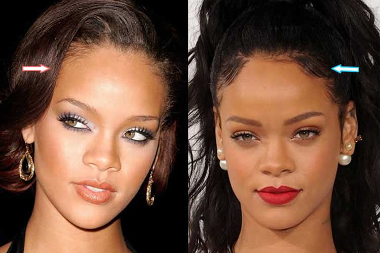 rihanna net eye color surgery