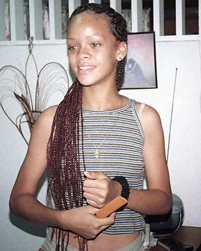 Rihanna Plastic Surgery