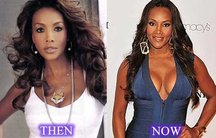 Vivica fox plastic surgery