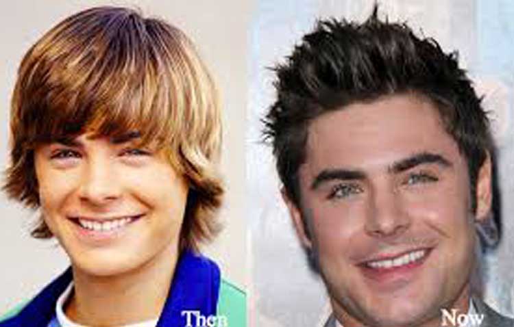 Zac Efron Plastic Surgery: Nose Job the Curious case of ...