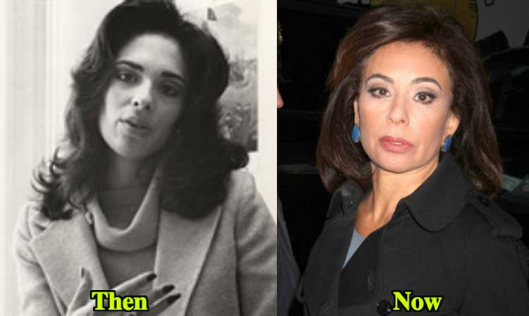 jeanine pirro plastic surgery