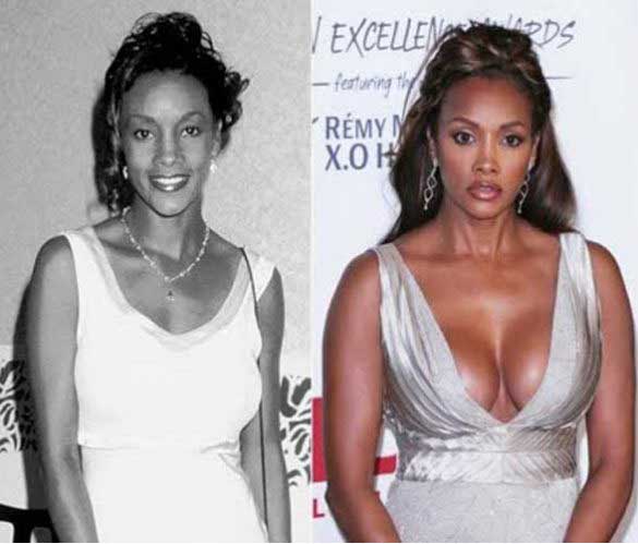 vivica fox plastic surgery