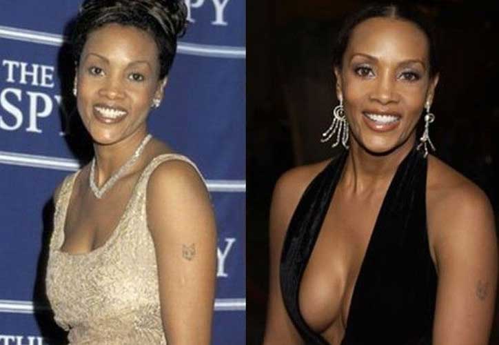 vivica fox plastic surgery