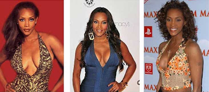 vivica fox plastic surgery