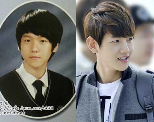 Baekhyun Plastic Surgery Nose Job. 