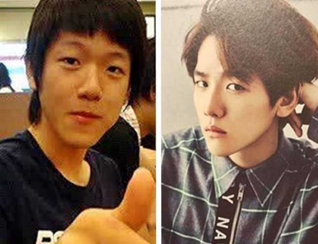 Baekhyun Plastic Surgery