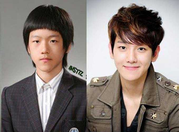 Baekhyun Plastic Surgery