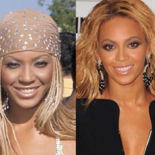 Beyonce Plastic Surgery