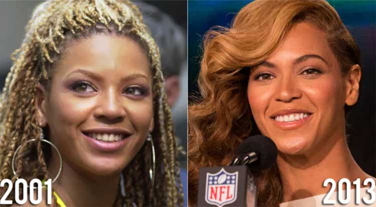 Beyonce Plastic Surgery