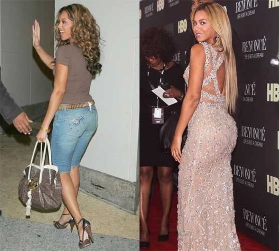 Beyonce plastic surgery