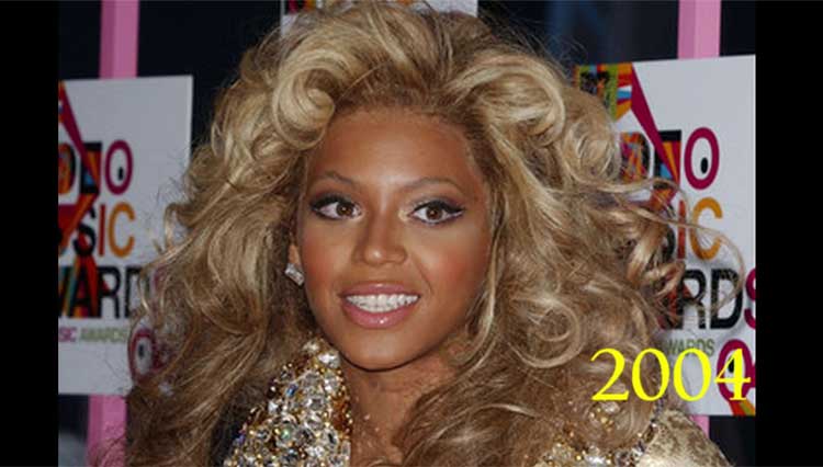 Beyonce plastic surgery