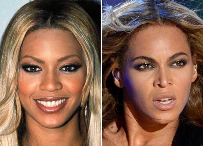 Beyonce plastic surgery