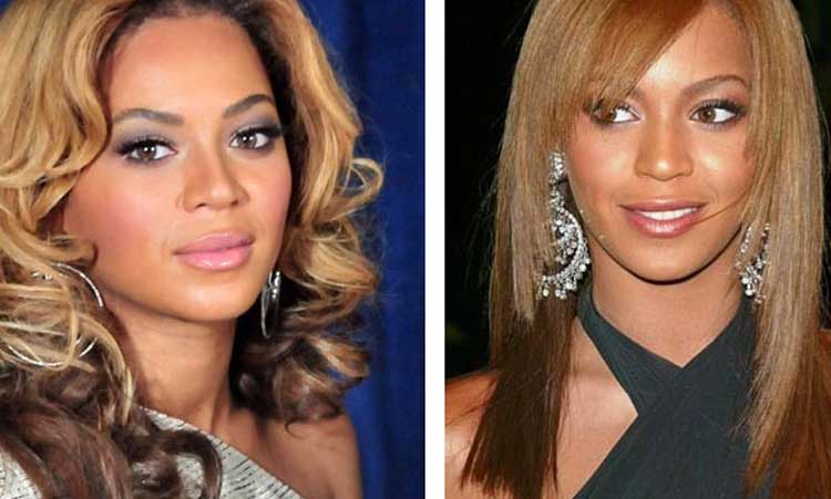 Beyonce plastic surgery 