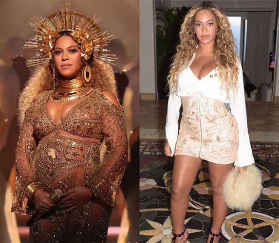 Beyonce plastic surgery