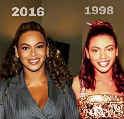 Beyonce plastic surgery