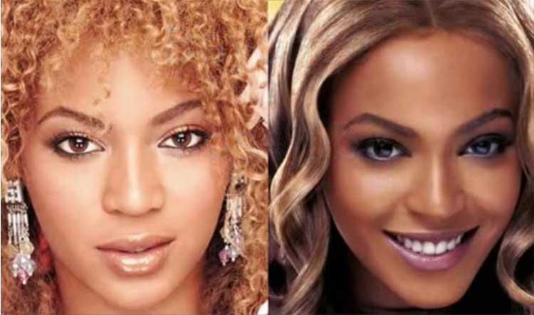 Beyonce plastic surgery