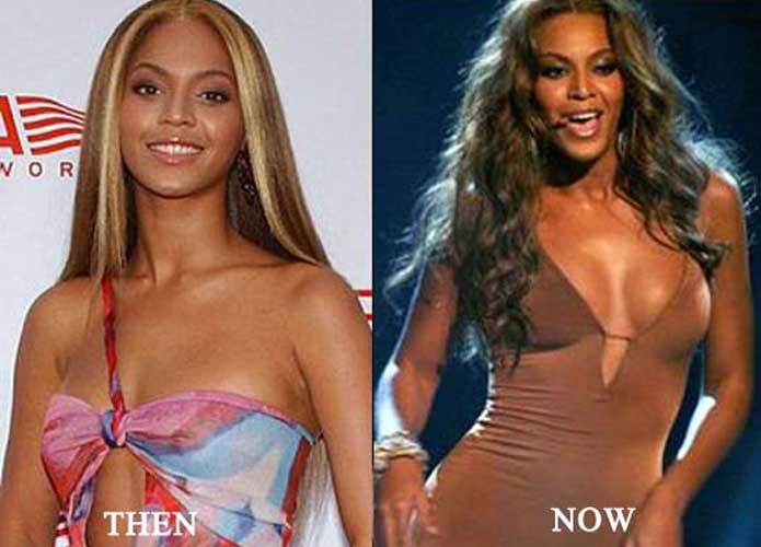 Beyonce plastic surgery