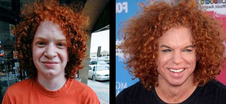 Carrot Top Plastic Surgery