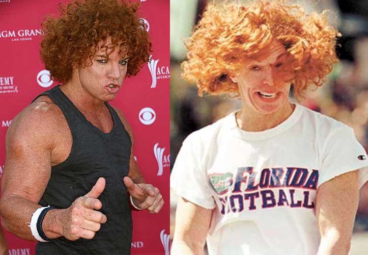 Carrot Top Plastic Surgery