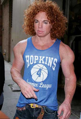 Carrot Top Plastic Surgery