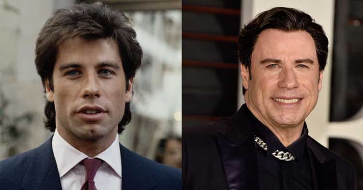 John Travolta plastic surgery