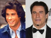 John Travolta Plastic Surgery: Facelift, Botox, Hair transplant