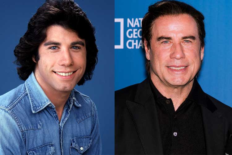 John Travolta plastic surgery