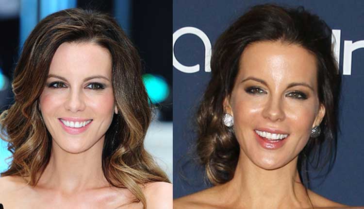 Kate Beckinsale Plastic Surgery: Boob Job, Nose Job, Botox ...