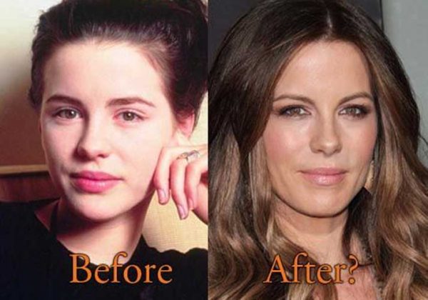 Kate Beckinsale Plastic Surgery Boob Job Nose Job Botox And Teeth