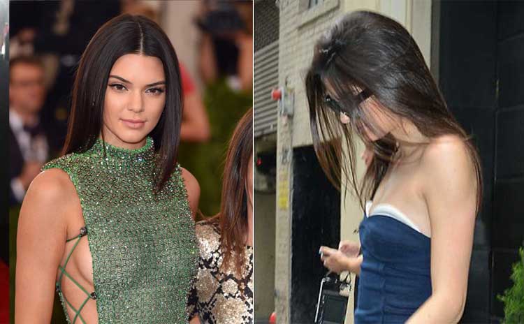 Kendall Jenner Plastic surgery 