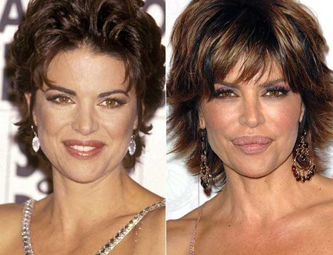 Lisa Rinna Plastic Surgery