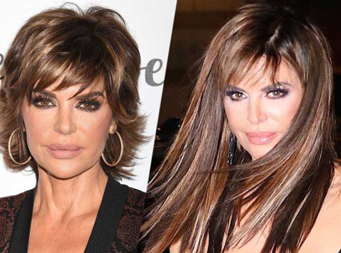 Lisa Rinna Plastic Surgery