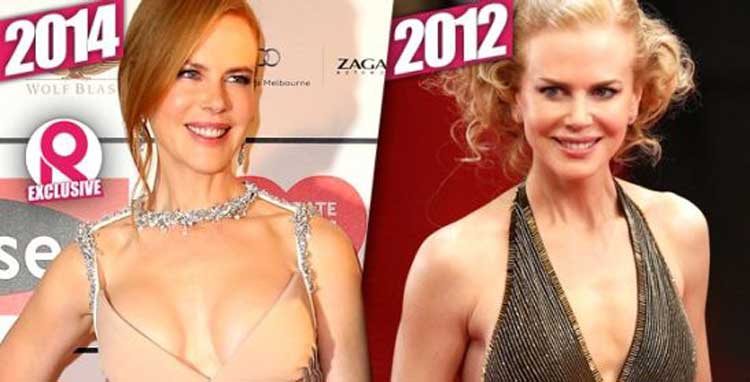 Nicole Kidman Plastic Surgery