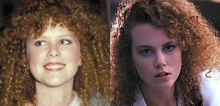 Nicole Kidman Plastic Surgery