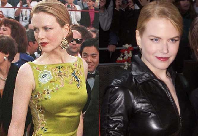 Nicole Kidman Plastic Surgery