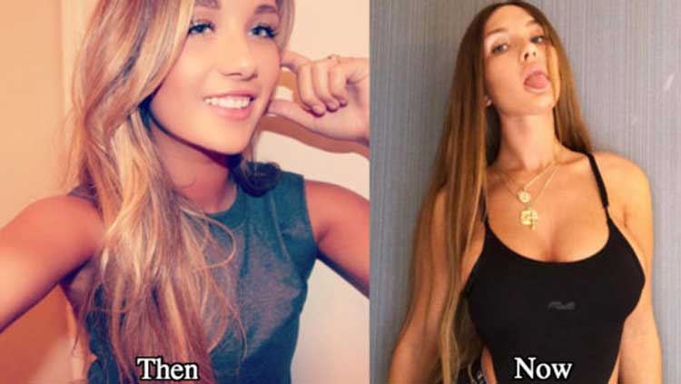 Niykee Heaton Plastic Surgery 