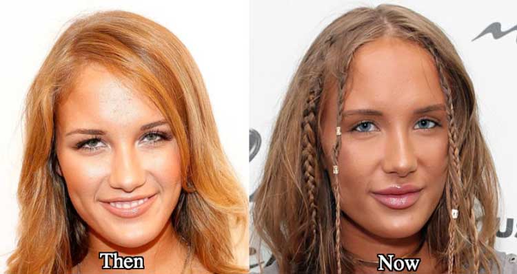 Niykee Heaton Plastic Surgery 