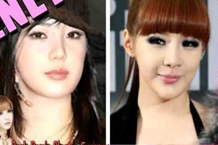 Park Bom Plastic Surgery