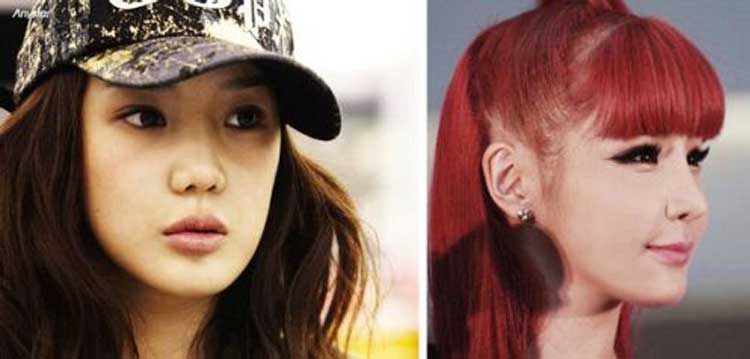 Park Bom Plastic Surgery