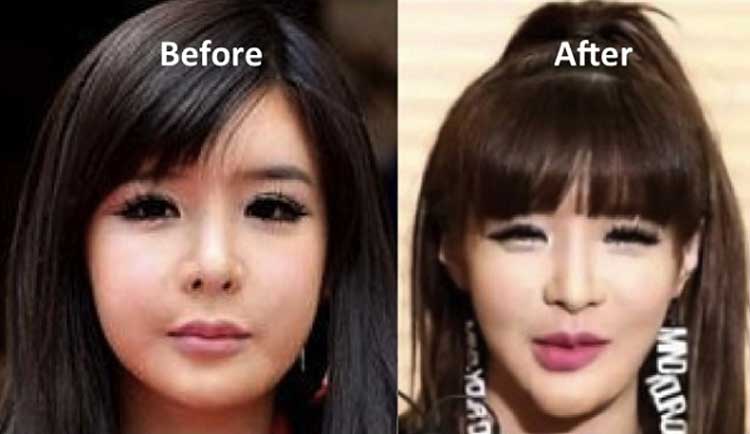 Park Bom Plastic Surgery