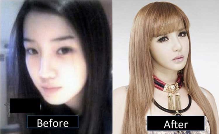 Park Bom Plastic Surgery