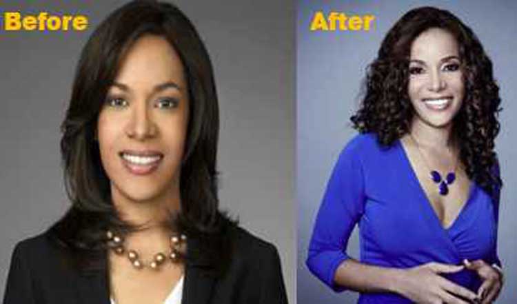 Sunny Hostin Plastic Surgery 