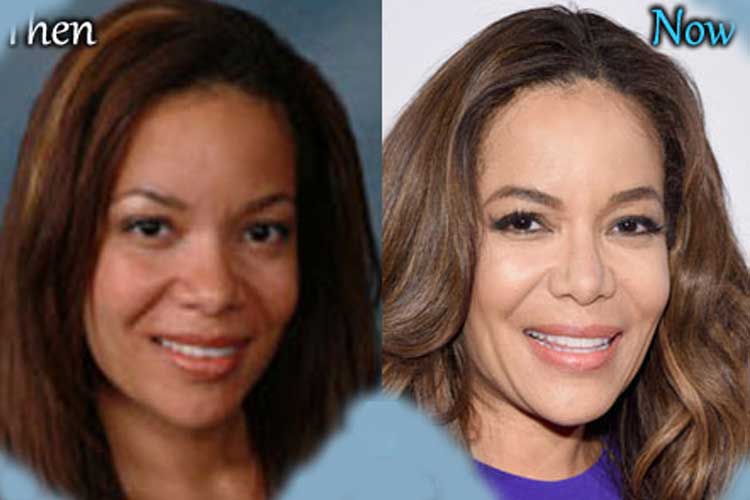 Sunny Hostin Plastic Surgery 