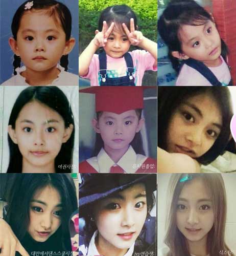 Tzuyu Plastic Surgery 