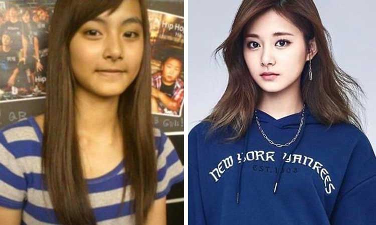 Tzuyu Plastic Surgery 