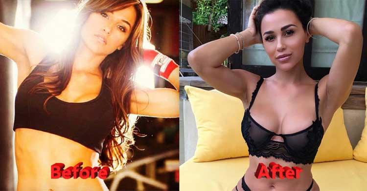 Ana Cheri before plastic surgery