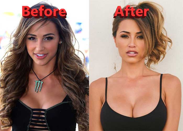 Ana Cheri before plastic surgery